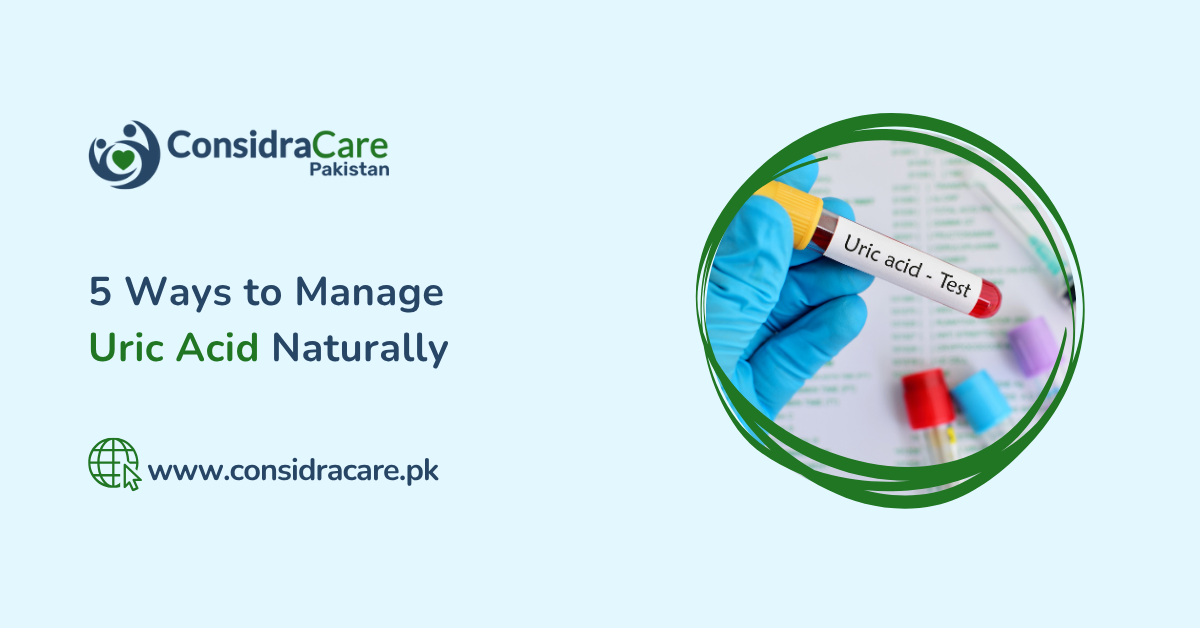 Ways to Manage Uric Acid Naturally