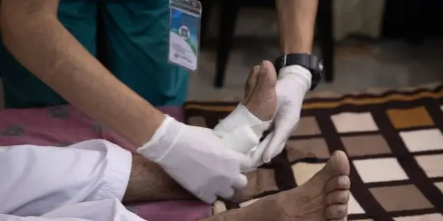wound dressing